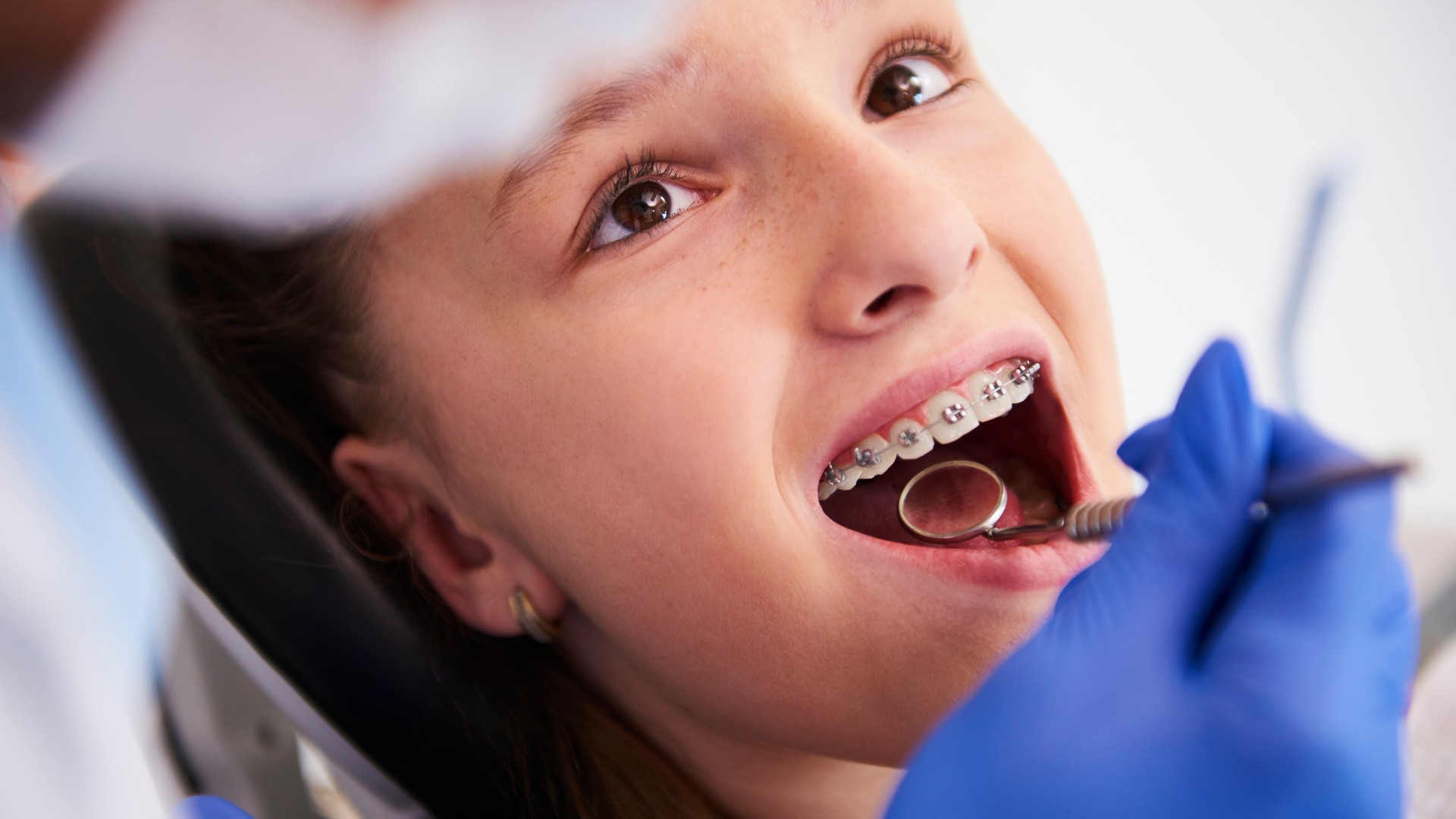 Braces Treatment For Kids