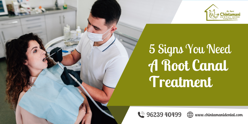 5 Signs You Need a Root Canal Treatment