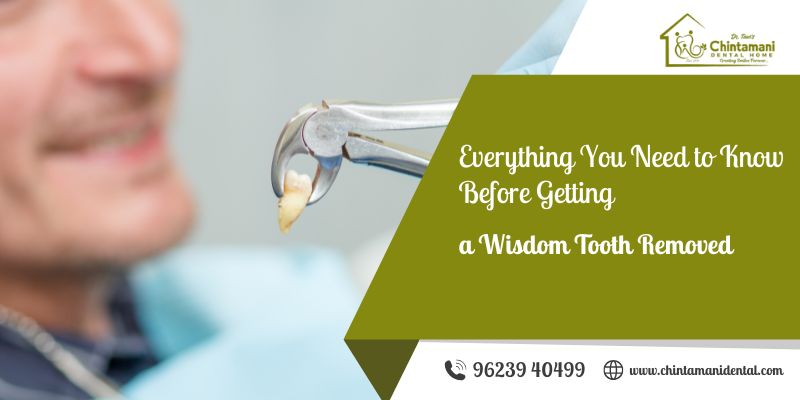 wisdom tooth removal in karad