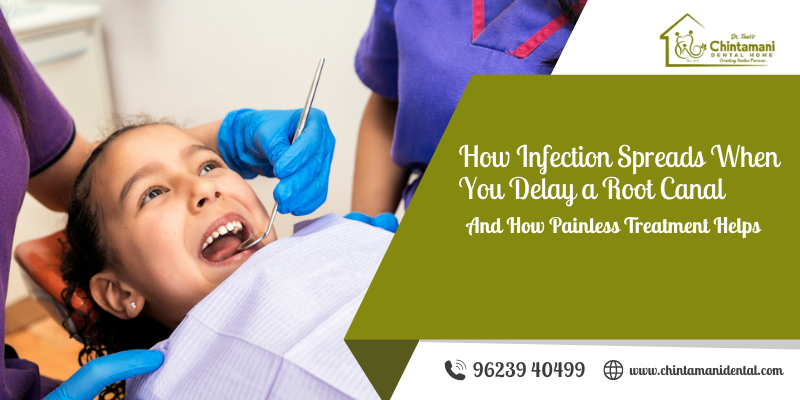 painless root canal treatment in Karad