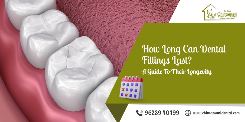 How Long Can Dental Fillings Last? A Guide to Their Longevity